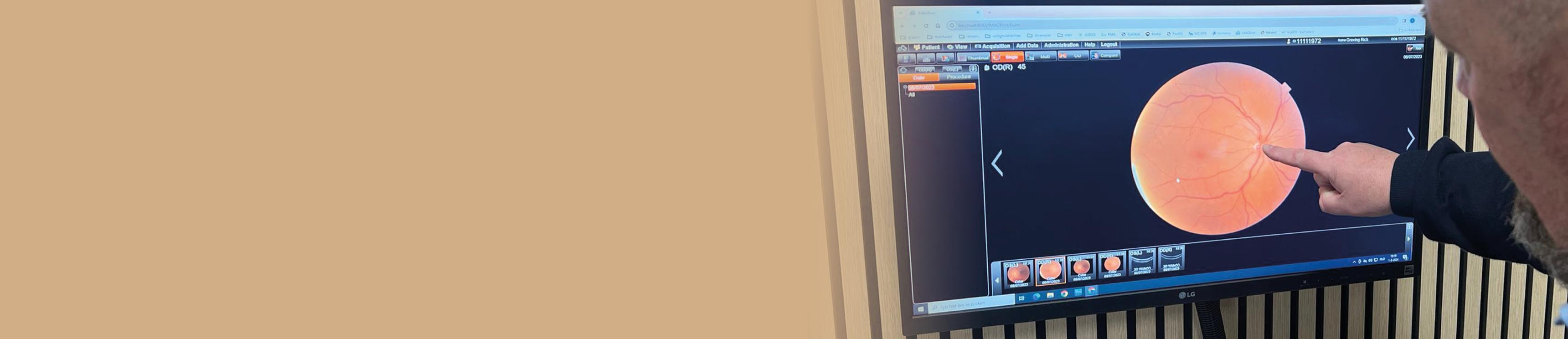ooggezondheidsonderzoek ooggezondheidsonderzoek